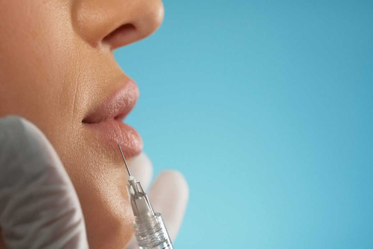 Aumento y Definición de Labios